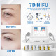 A0259 two handles 7D hifu facial lift machine with 7 cartridges