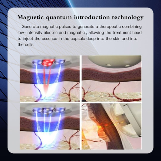 A0655 2023 New Arrivals 5D Magnetic Quantum facial beauty equipment for skin tightening wrinkles removal moisturizing A0655 2023 New Arrivals 5D Magnetic Quantum facial beauty equipment for skin tightening wrinkles removal moisturizing