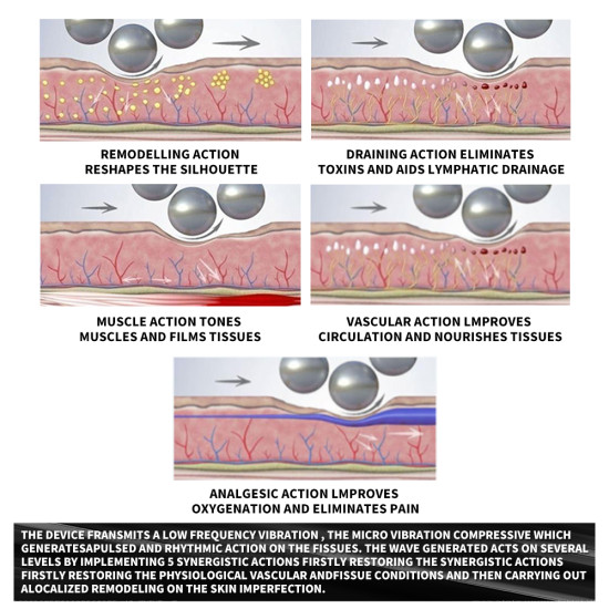 B0153 Inner ball cellulite roller inner ball roller massage machine B0153 Inner ball cellulite roller inner ball roller massage machine