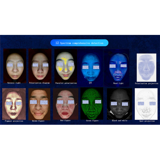 J0108 2023 New Portable 3d AI Wood Lamp Skin Detector Tester Analyzer Reveal Facial Scanner Face Camera Visia Skin Analysis Machine J0108 2023 New Portable 3d AI Wood Lamp Skin Detector Tester Analyzer Reveal Facial Scanner Face Camera Visia Skin Analysis Machine