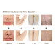A0412 Multifunctional Skin Rejuvenation Laser Therapy Beauty 2 in 1 Diode Hair Removal Machine A0412 Multifunctional Skin Rejuvenation Laser Therapy Beauty 2 in 1 Diode Hair Removal Machine