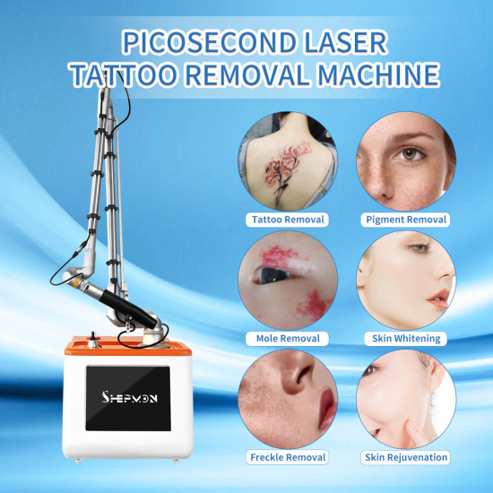 A0502 Newest 2023 Cheap picosecond Laser Machine Tattoo Removal For Salon Use Skin Whitening