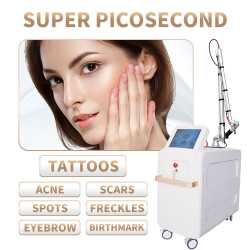 A0512 Q Switch ND Yag Laser Tattoo Removal Machine For Carbon Laser Peel Black Doll