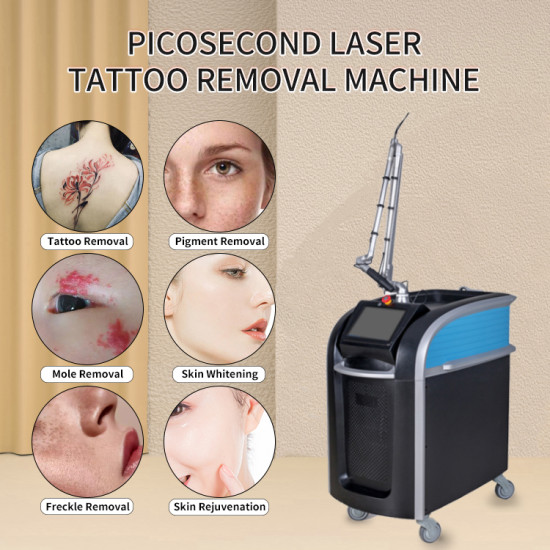 A0513 Nd Yag Laser 532nm 1064nm 755nm Picosecond Pico Laser Q-switched Tattoo Removal Machine