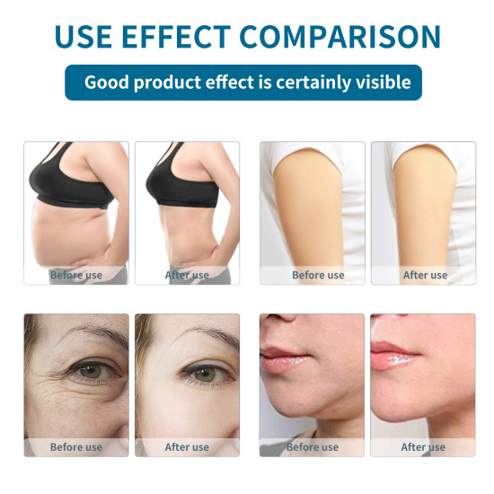 B0112 6 in 1 40K Fat Cavitation And RF Skin Tightening Machine With Vacuum Cavitation System(except cryolipolysis slim)