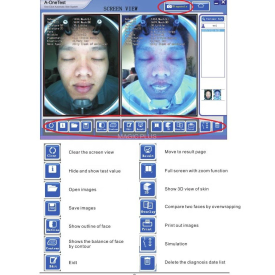 J0116 Face Mirror Visia 3D Facia Skin Analysis Machine