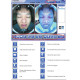 J0116 Face Mirror Visia 3D Facia Skin Analysis Machine