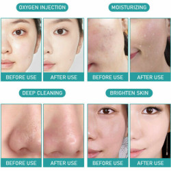 A0636-7 hydrodermabrasion facial machine 7 in 1 oxygen spray ultrasonic led facial mask beauty machine