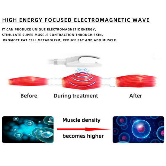 A0241C Portable Emslim 4 Handle Ems RF Neo Emslim Machine / Portable Ems Body Sculpting Machine A0241C Portable Emslim 4 Handle Ems RF Neo Emslim Machine / Portable Ems Body Sculpting Machine