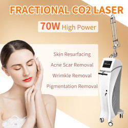 A0528 New Beauty Trends Medical Fractional Co2 Laser System Laser Co2 Fraccionado Portatil Vaginal Y Corporal For Vaginal Tightening A0528 New Beauty Trends Medical Fractional Co2 Laser System Laser Co2 Fraccionado Portatil Vaginal Y Corporal For Vaginal Tightening