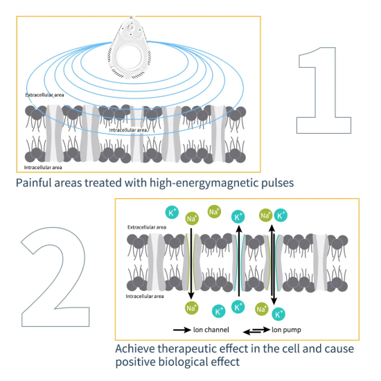 A0271 New Arrivals Physio Magnetic Therapy Pain Relief Machine A0271 New Arrivals Physio Magnetic Therapy Pain Relief Machine